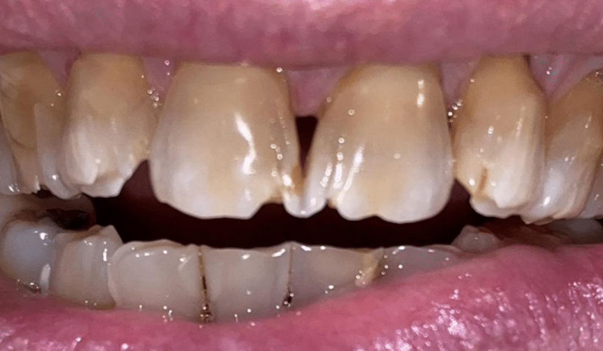 Before