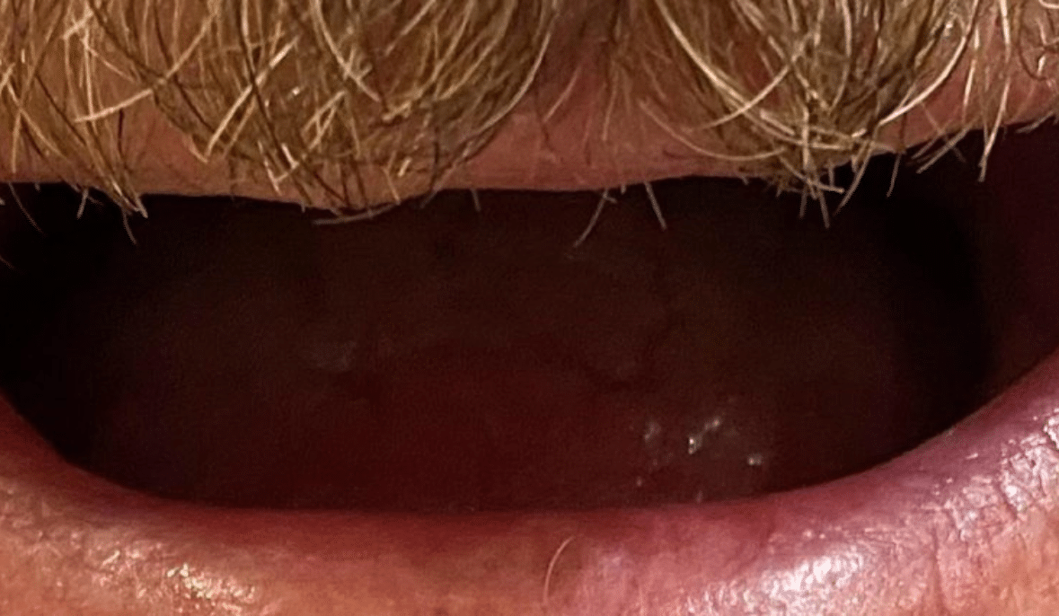 Before